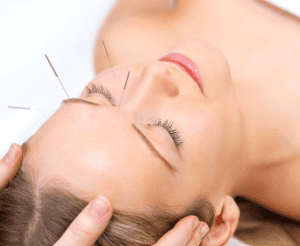 We offer acupuncture facial in Waterloo Kitchener area. Contact us for more details!