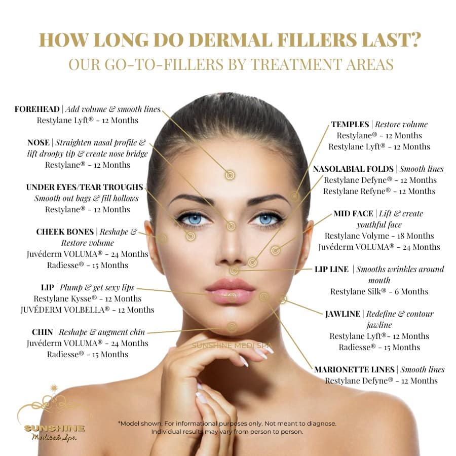 Typical time last for our go-to dermal fillers of different treatment areas