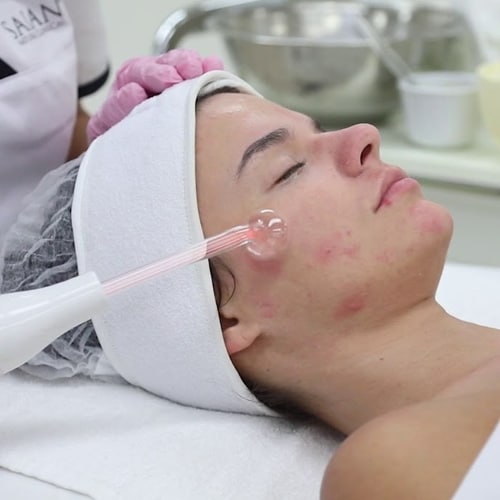 We provide acne facials and we are the top acne clinic in Waterloo Kitchener region. Contact us for more details.