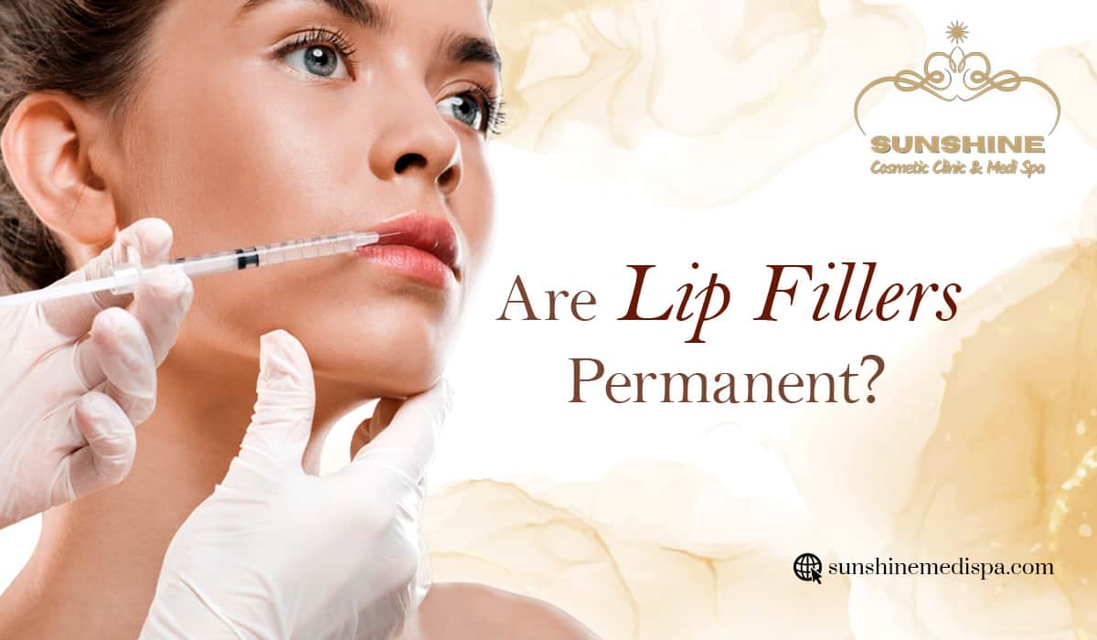 Are Lip Fillers Permanent?